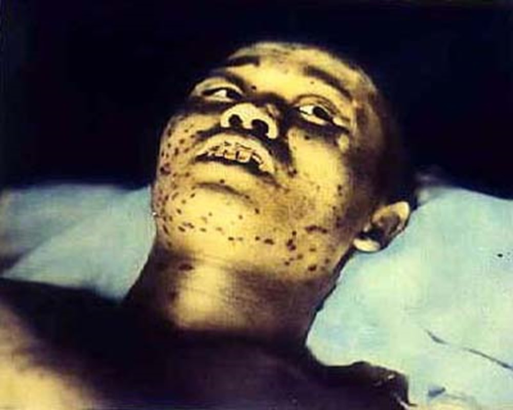 İnsanlığın kaybettiği yer: Hiroşima - 11