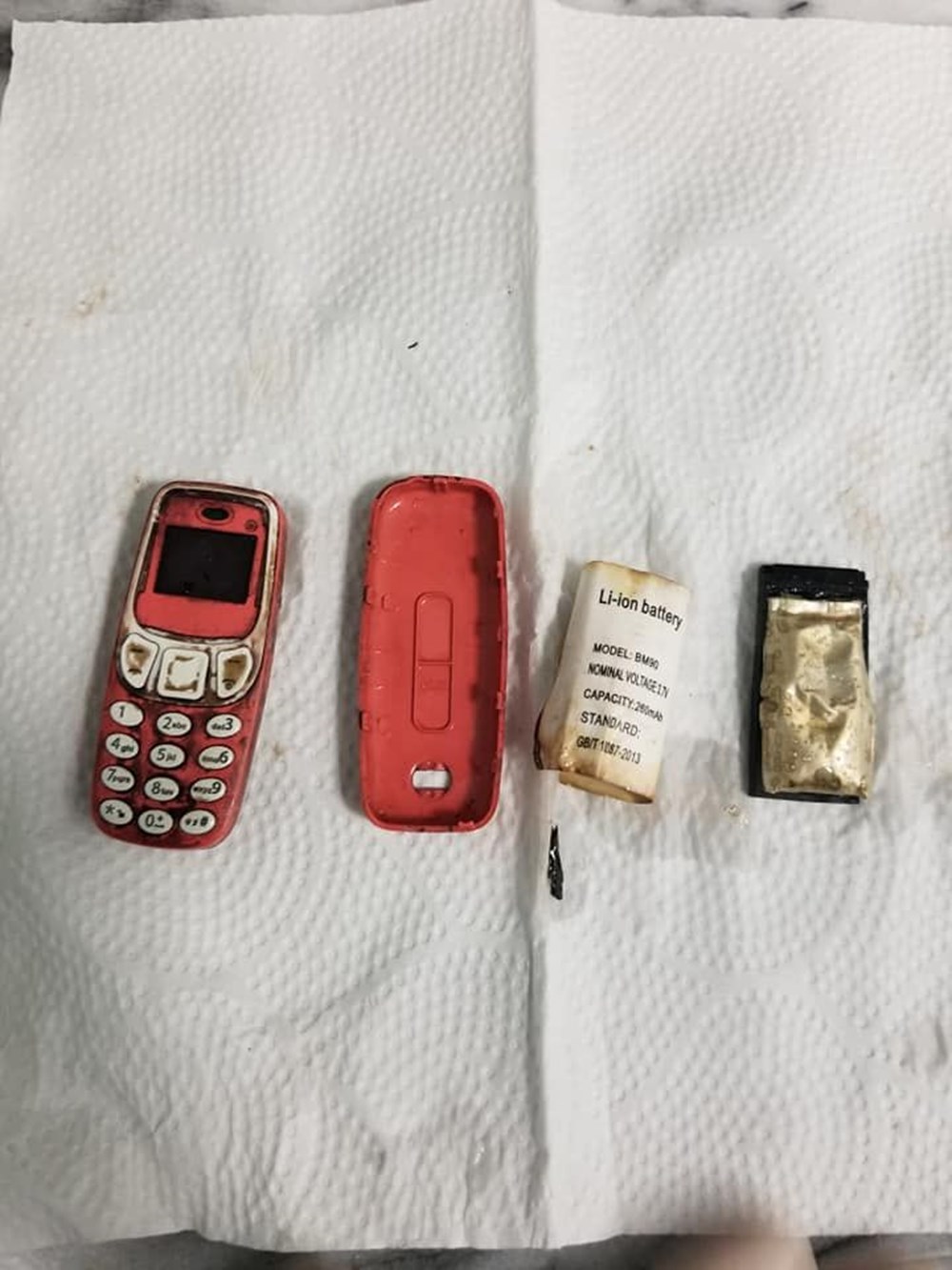 Doktorları şaşırtan ameliyat: Midesinden Nokia 3310 çıktı - 5