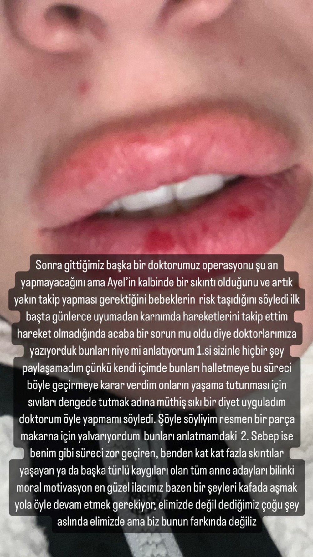 Yasemin Şefkatli zorlu hamilelik sürecini ilk kez anlattı: Yataktan kalkamıyordum - 6