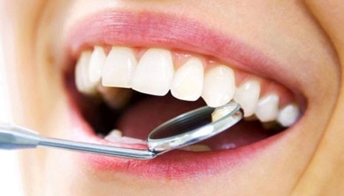 Diş taşı nedir? Neden olur? Diş taşı nasıl temizlenir ve önlenir?