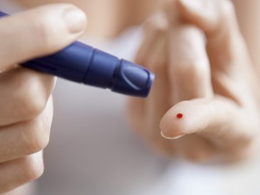 Diyabetik Ayak Yaralari Organ Kaybina Neden Olabilir Saglik Haberleri Ntv