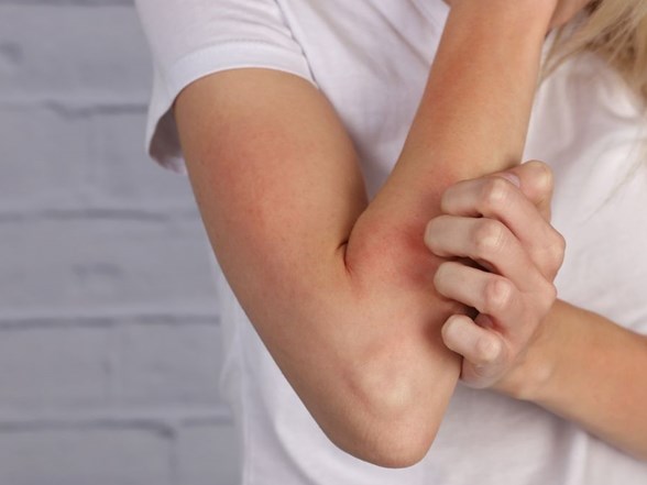 cilt kurulugu ve kasinti bobrek yetmezliginin habercisi olabilir