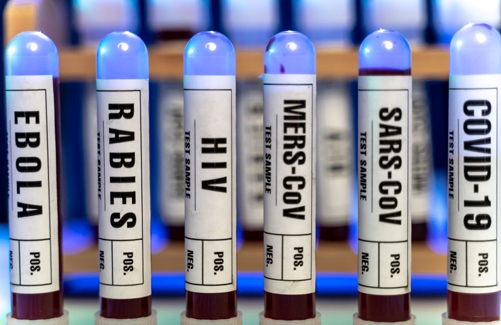 DSÖ uyardı: 2022 FIFA Dünya Kupası Covid-19'dan daha ölümcül bir pandeminin kaynağı olabilir (Deve gribi nedir?) - 2