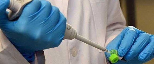 İnsan spermindeki protein Ebola'nın yayılma riskini arttırıyor