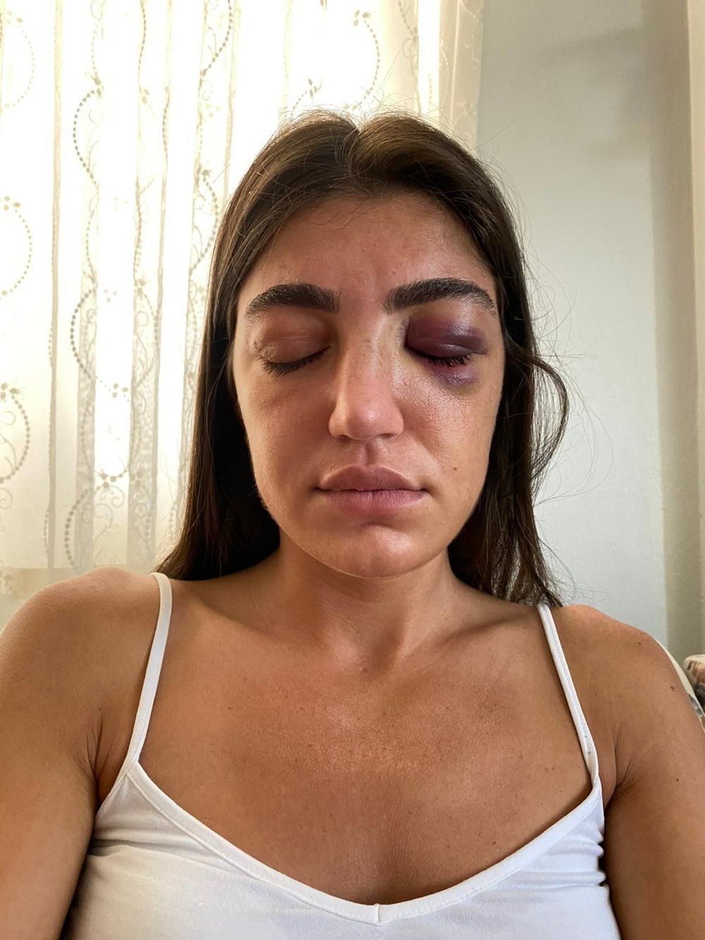 Model Gizem Akbaş'a öldüresiye dayak (Mücahit İsmail Ayta tutuklandı) - 11