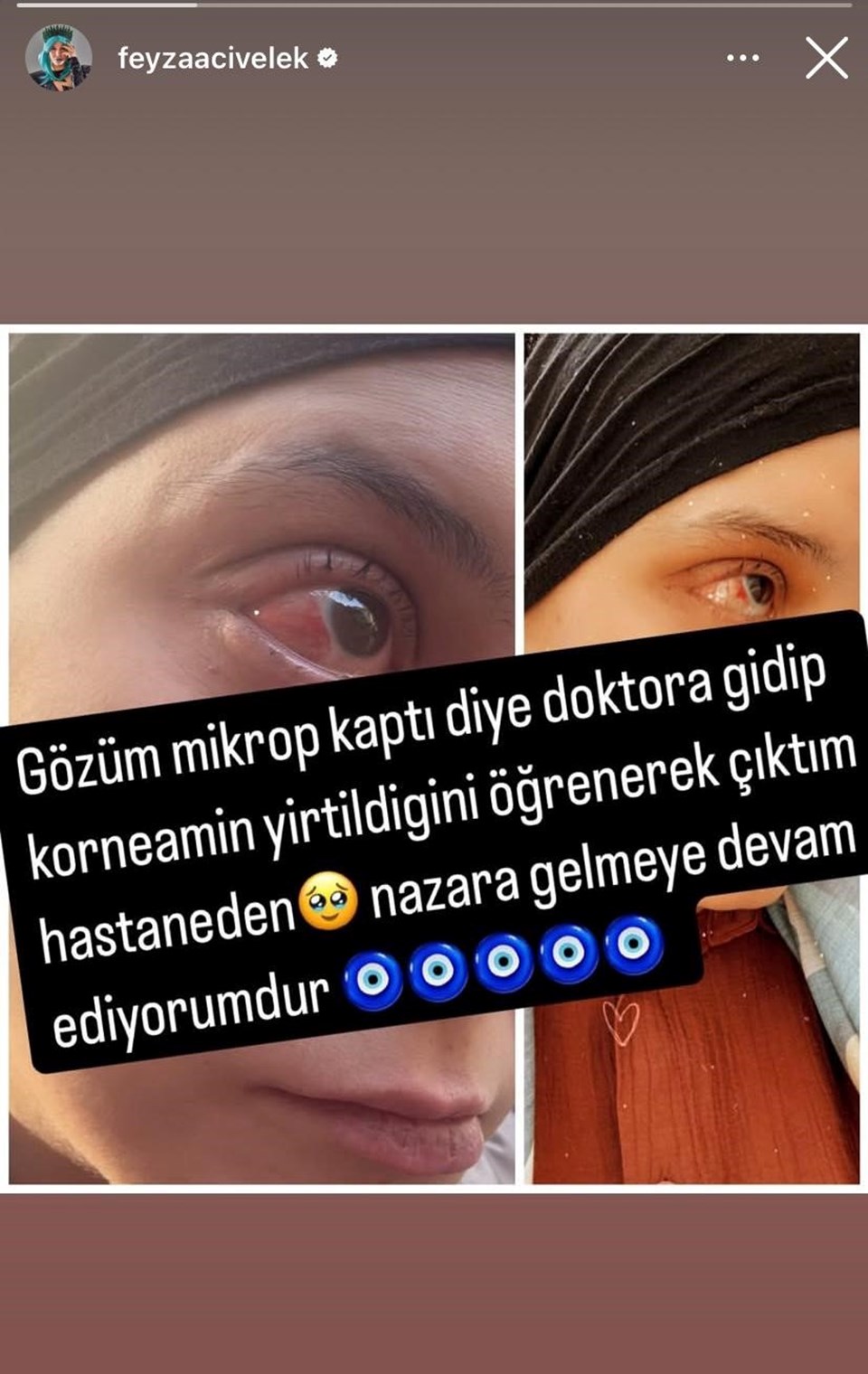 Feyza Civelek: Nazara gelmeye devam ediyorum - 2