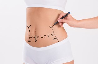 9 Soruda Yuz Gerdirme Ameliyati Kaliciliginin Uzun Surmesi Icin Neler Yapilmali Saglik Haberleri Ntv