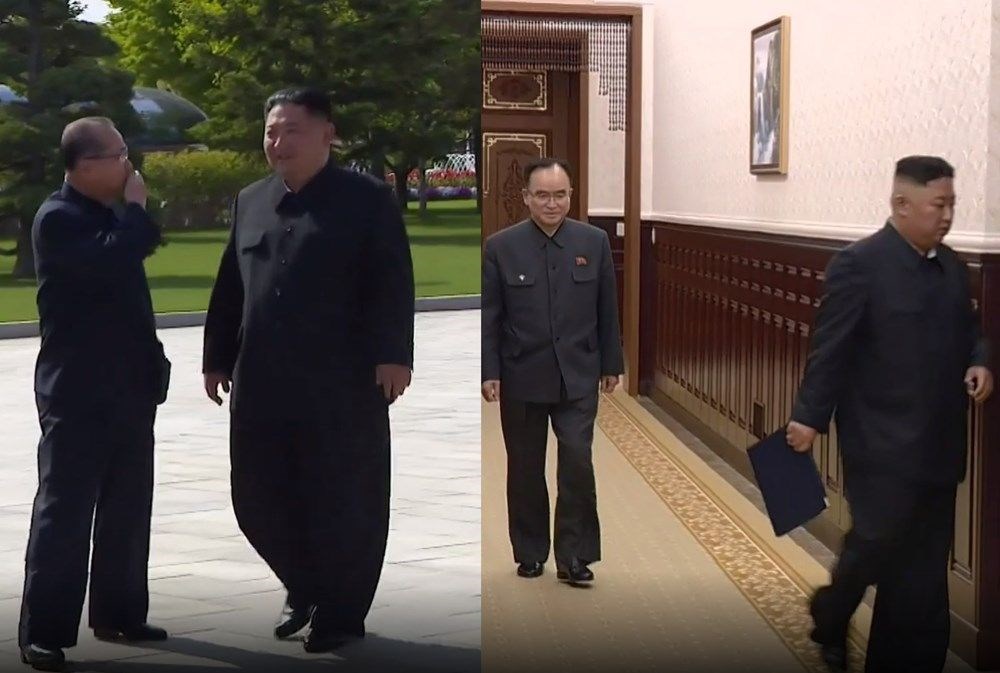 Kim Jong-Un zayıfladı, boynu ortaya çıktı - 9