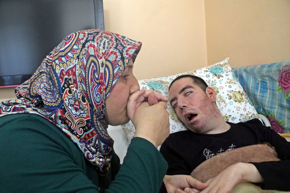 13 yıl gözlerini hiç kapatamadı, sesi kısık kaldı: SSPE hastası gencin acı öyküsü 72