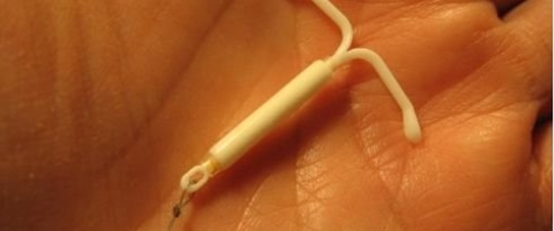 В какой день цикла ставится спираль. В какой день цикла ставится спираль. Спираль противозачаточная мирена. Внутриматочная гормональная спираль мирена. Внутри маточние спиралы.