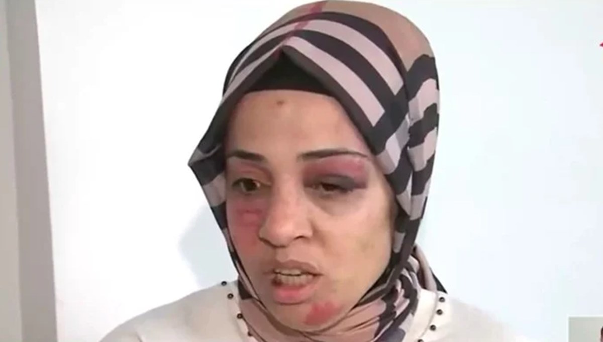 İstanbul'da kadına şiddet! Eski eşinin anne ve babası sokak ortasında dövdü İstanbul'da kadına şiddet! Eski eşinin anne ve babası sokak ortasında dövdü