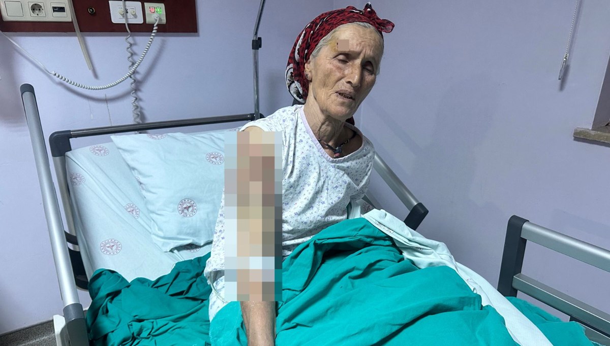 65 yaşındaki kadına 7 köpek saldırdı: Vücuduna 50 dikiş atıldı! 65 yaşındaki kadına 7 köpek saldırdı: Vücuduna 50 dikiş atıldı!