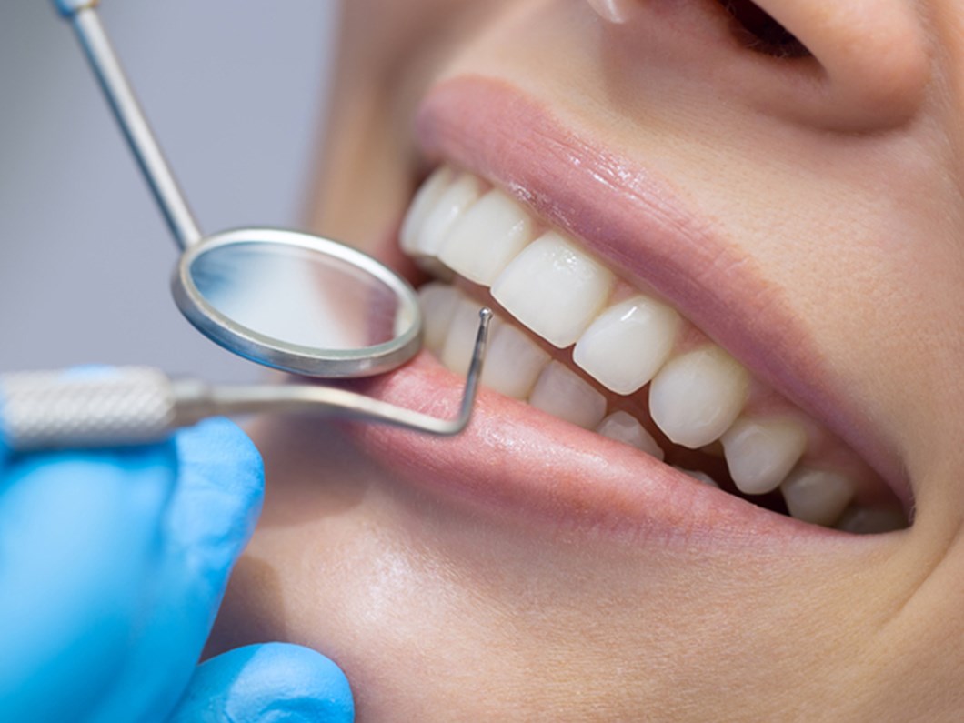 Dis Apsesi Beyin Iltihabina Neden Olabilir Saglik Haberleri Ntv