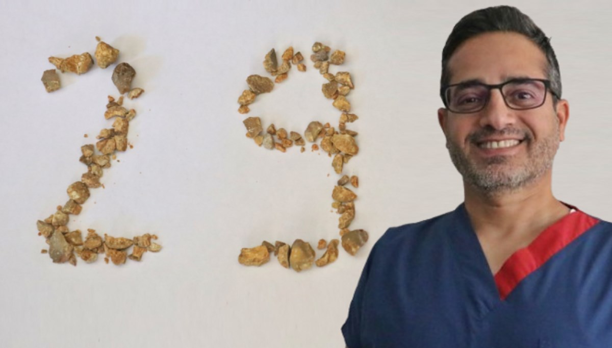 Profesörün ilginç kutlaması: Böbrek taşlarıyla 29 Ekim kutlaması yaptı Profesörün ilginç kutlaması: Böbrek taşlarıyla 29 Ekim kutlaması yaptı