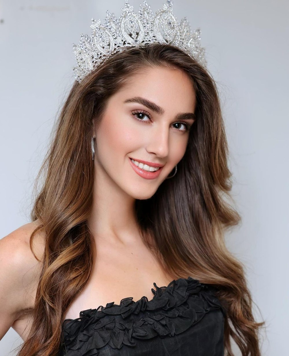 Miss Turkey birincisi İdil Bilgen'in son hali tartışma yarattı - 7