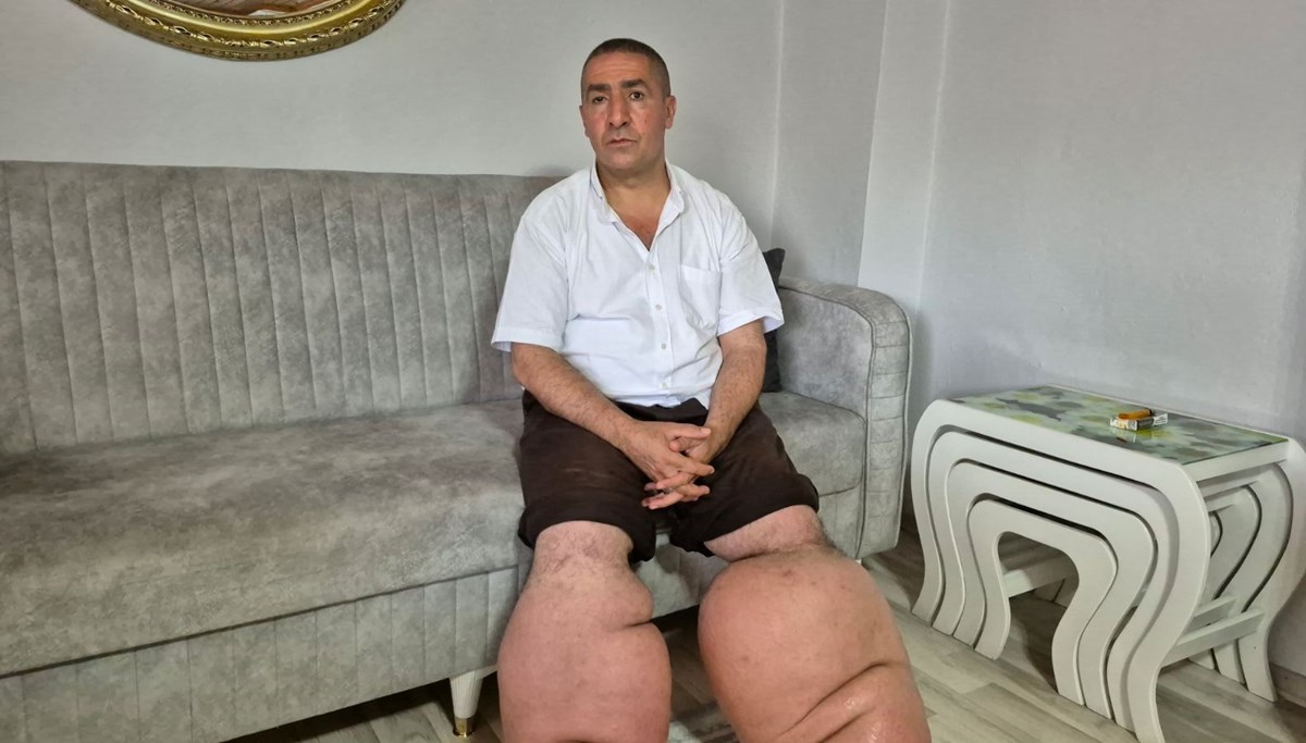Yüksek ateş şikayetiyle hastaneye gitti: 15 yıldır bu hastalıkla savaşıyor