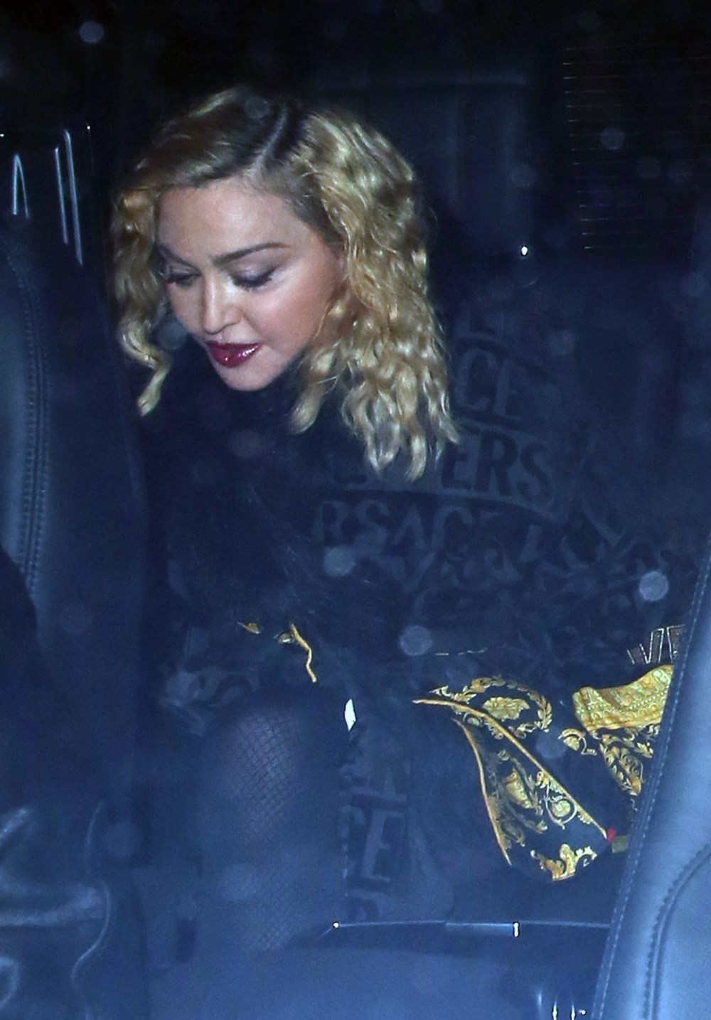 Madonna’nın son hali (Hastalık mı estetik mi?) Magazin Haberleri NTV
