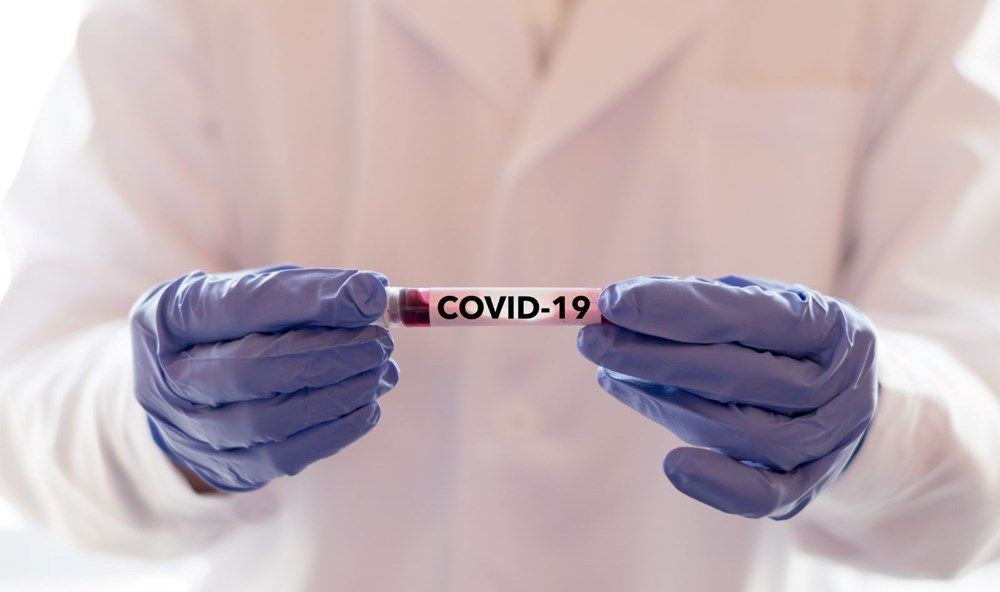 Covid-19 nasıl ortaya çıktı? Yeni iddialar - 32