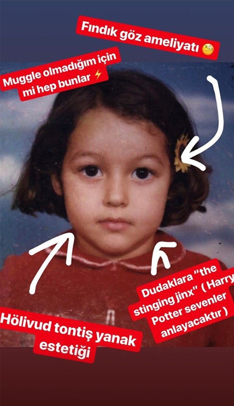 Dilan Çiçek Deniz Yüzümde hiç estetik yok Magazin Haberleri NTV