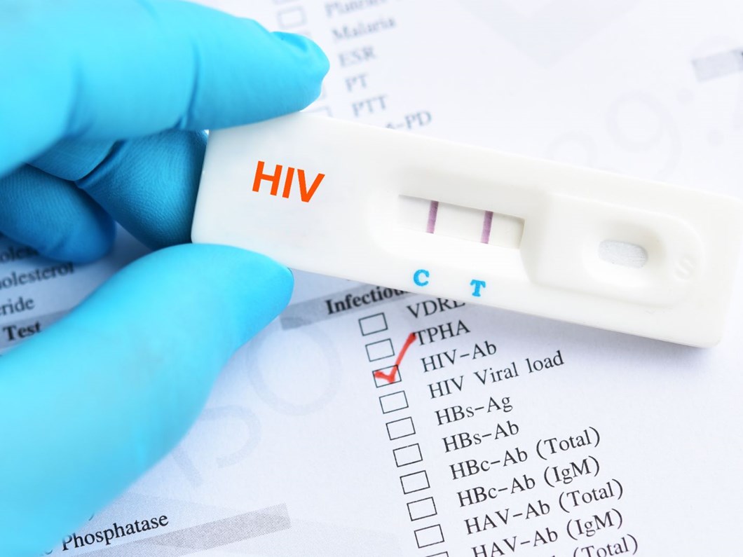 1 Aralık Dünya AIDS günü: Ülkemizde 26 bin 164 HIV tanısı alan hasta var - Sağlık Haberleri