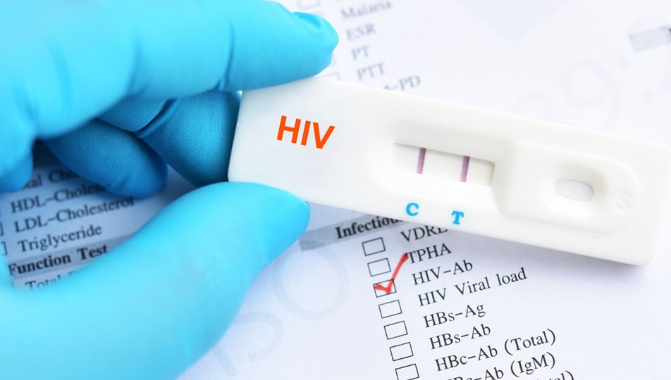 1 Aralık Dünya AIDS günü: Ülkemizde 26 bin 164 HIV tanısı alan hasta var