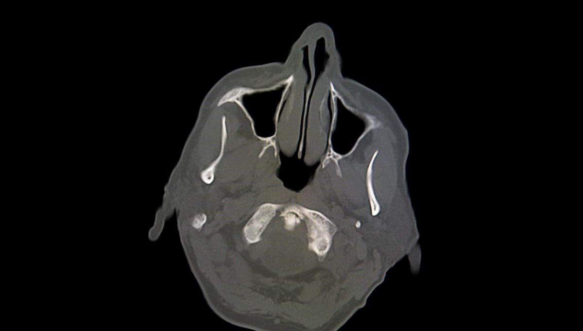 Yıllar sonra  Yıllar sonra