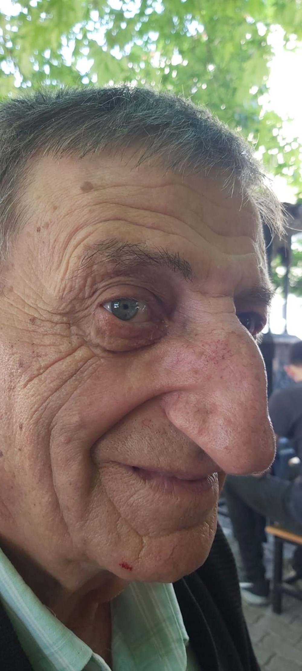 Burnuyla Guinness Rekorlar Kitabı'na girmişti, hayatını kaybetti - 4