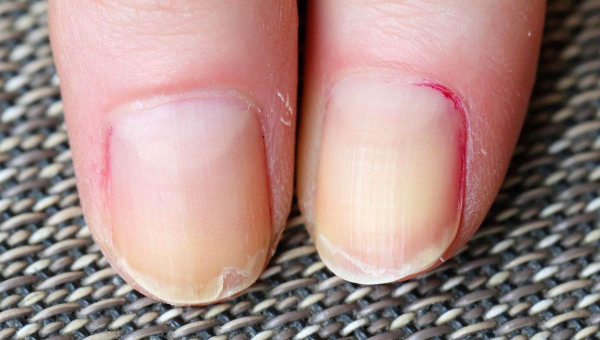 Hızlı mı yaşlanıyorsunuz yavaş mı? Tırnaklarınız ele veriyor