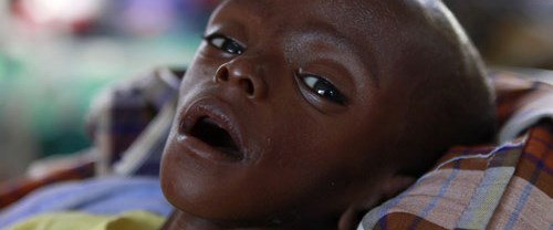 Minhaj bebek ölümü yendi NTV