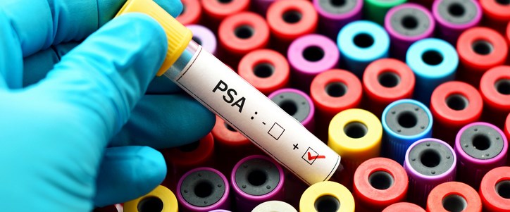 Prostat kanseri teşhisinde 