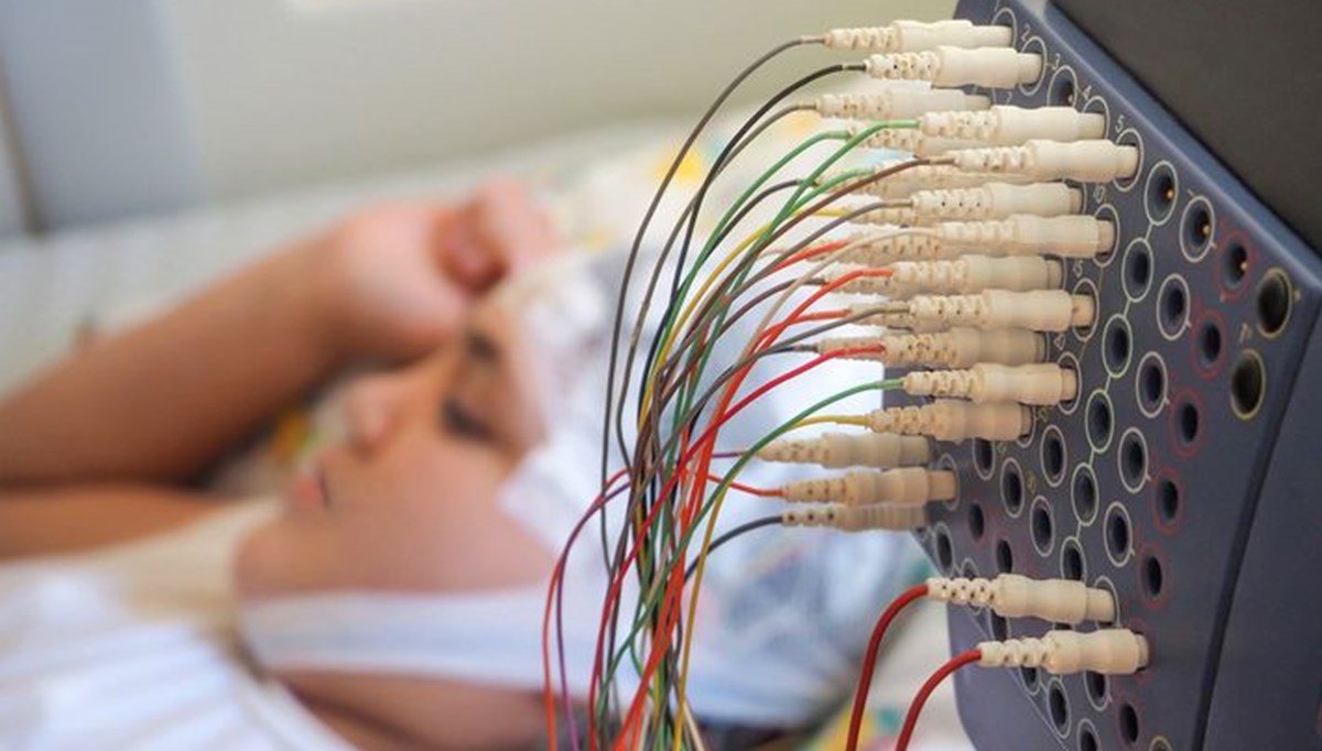 Tıp tarihinde bir ilk! Epilepsi hastası çocuk kafasına yerleştirilen cihazla iyileşti Tıp tarihinde bir ilk! Epilepsi hastası çocuk kafasına yerleştirilen cihazla iyileşti