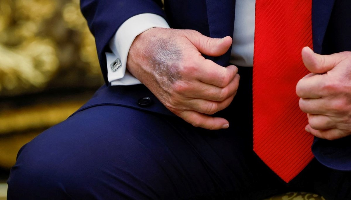 Trump eli gündem oldu