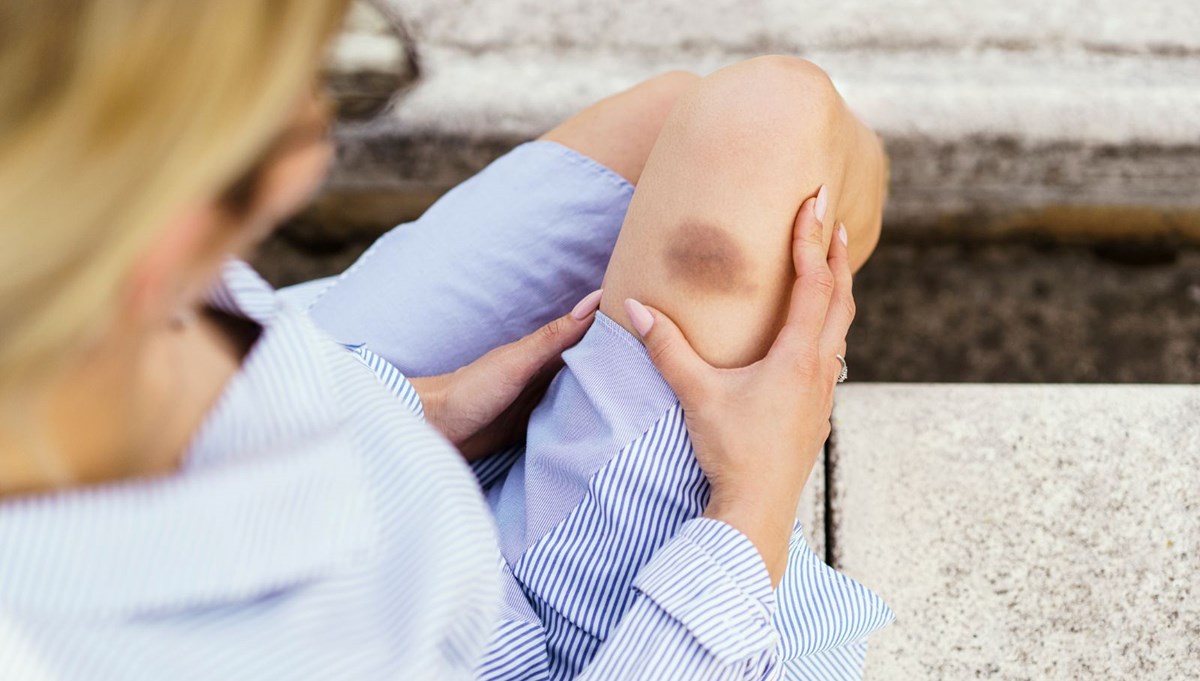 Karaciğerinizin kötü durumda olduğunu gösteren 5 işaret: ABD'li doktor açıkladı! Kimse farkında değil ama sessizce ölüme götürüyor