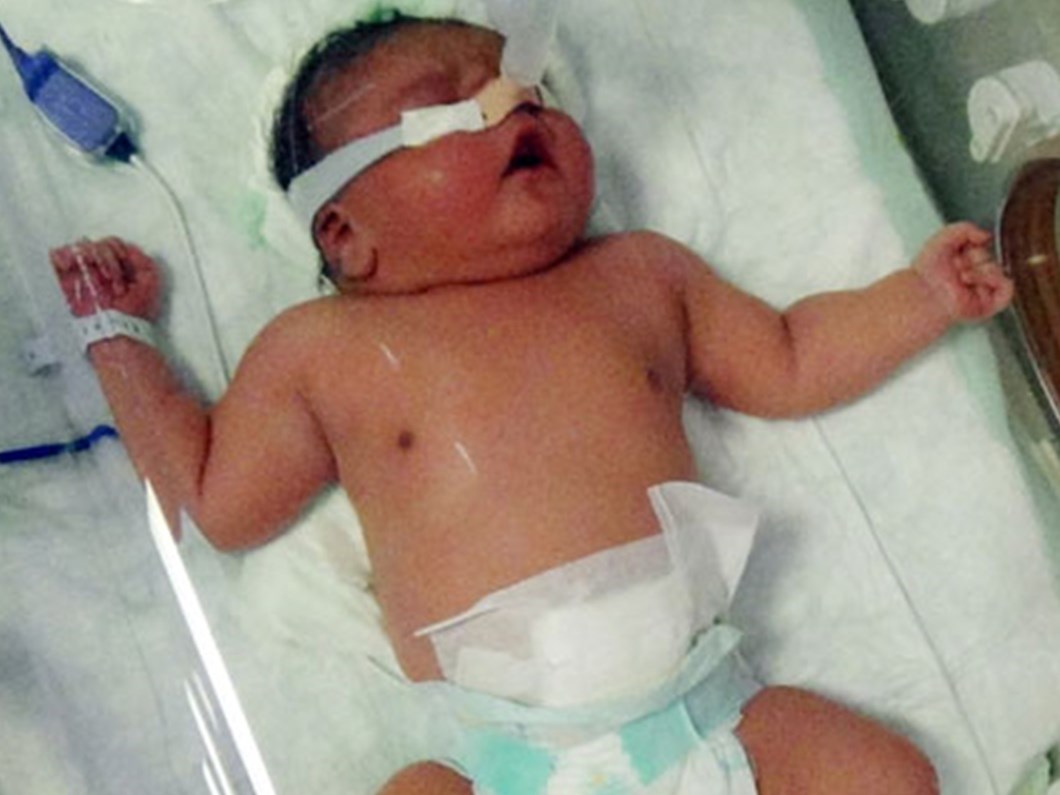 5 kilo 750 gram dogdu saglik haberleri ntv