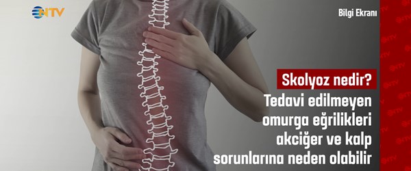 Bilgi EkranÄ±: Skolyoz nedir?