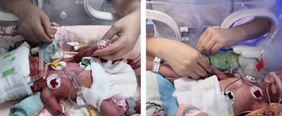 Çin’de bir kadın üç kez düşük yaptıktan sonra dördüz doğurdu - 2