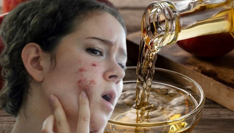 Cilt lekelerini açan doğal aydınlatıcı: Geceler suyla karıştırıp sürmek yetiyor