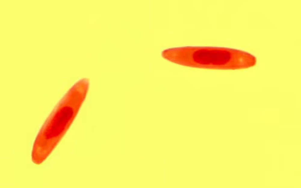 Zombi mantar salgını uyarısı: İnsanların beynini ele geçirip davranışlarını kontrol edebilir - 6