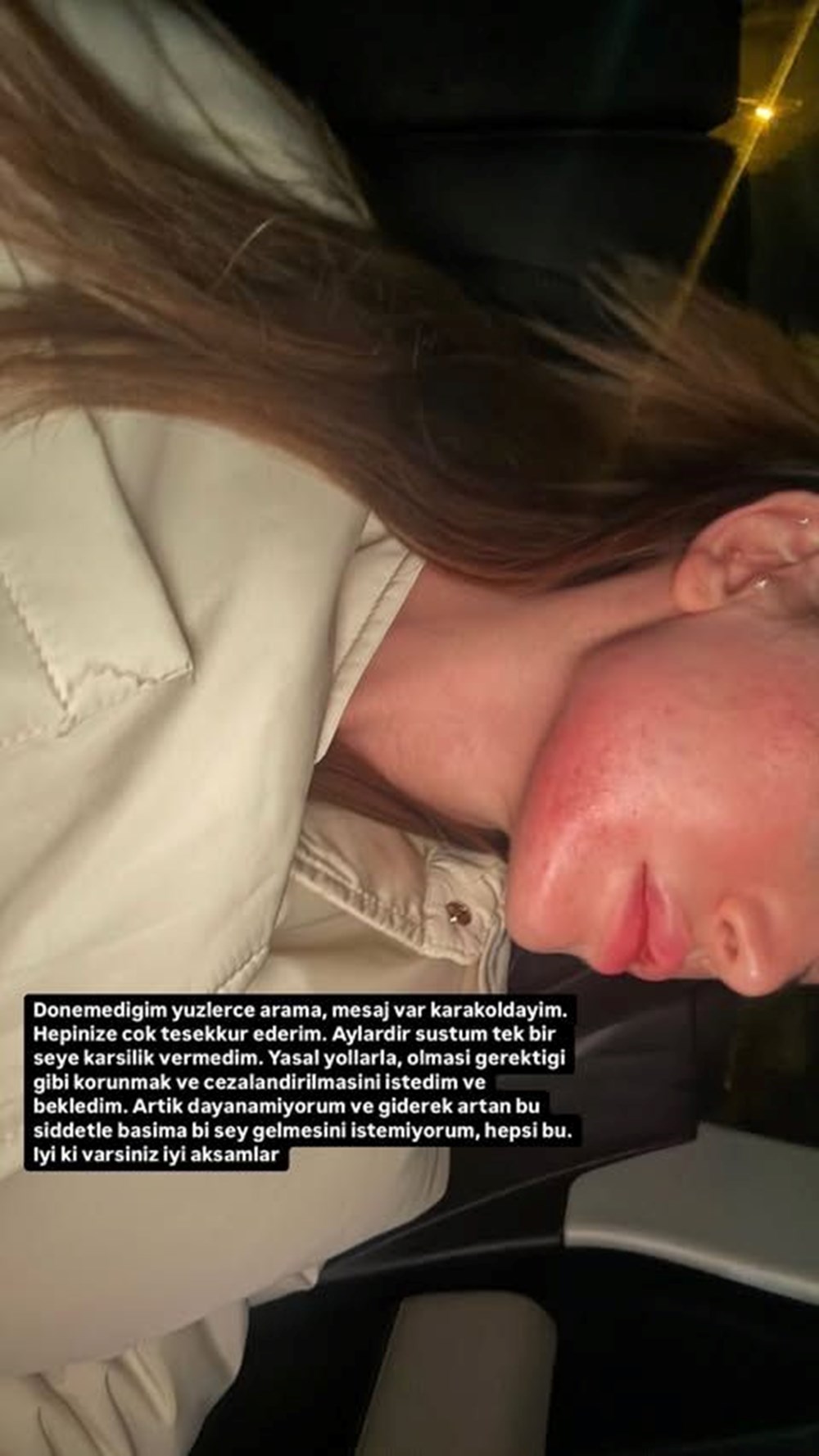 Danla Bilic darp fotoğrafını paylaştı | Eski sevgilisi tutuklandı 73 rZ0X2B3NnkC mtsAnEfOqQ