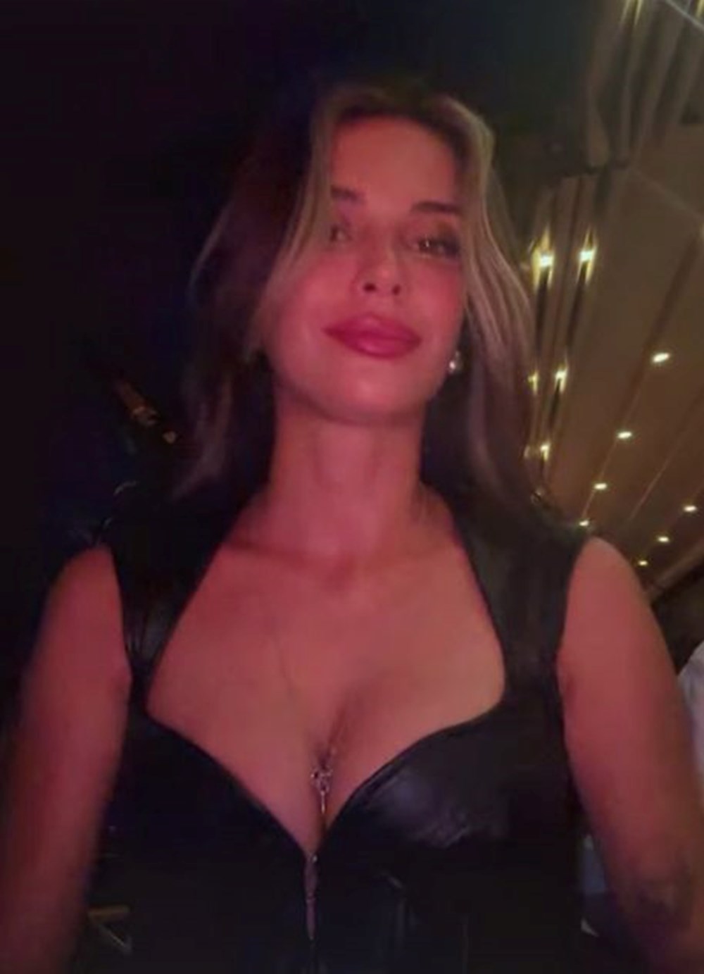 Devrim Özkan'dan ameliyat sonrası yeni imaj: İyileşildi gibi (Ünlülerin değişimi) - 2