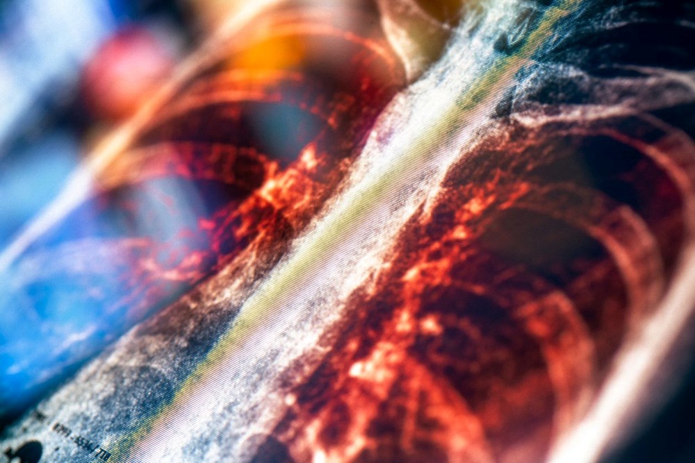 DNA analizi, Kara Veba’nın kaynağını ortaya çıkardı - 6