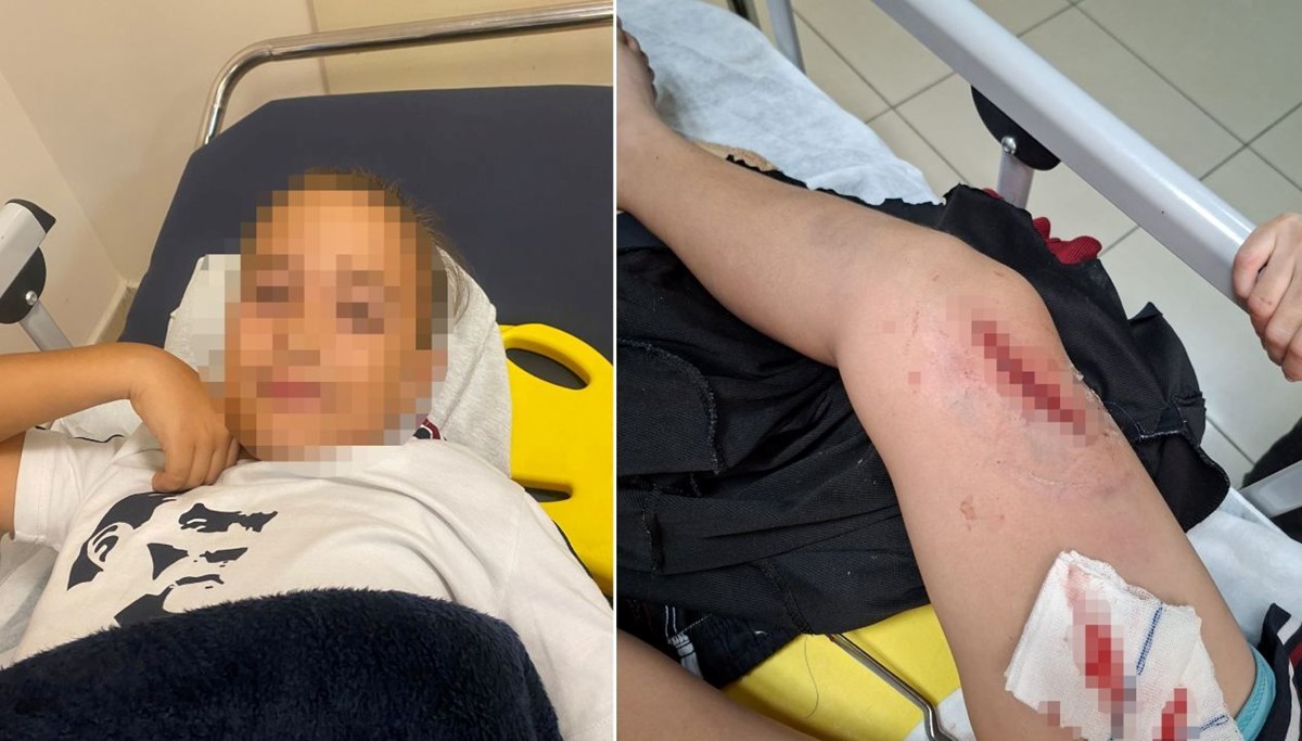 Okul bahçesinde bayrak direği devrildi: 1 yaralı