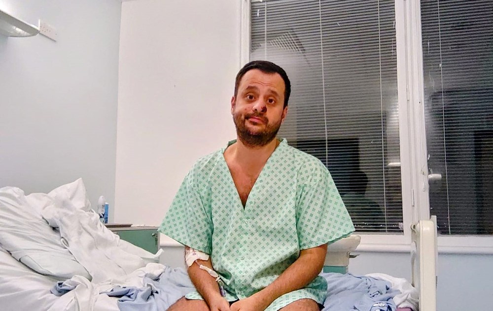 Dünyanın konuştuğu hasta: Önce HIV ve Covid sonra da maymun çiçeği - 12