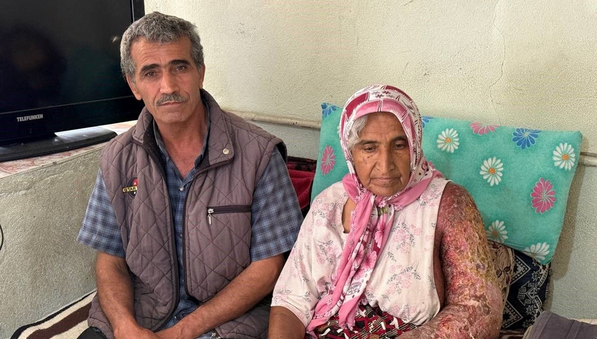 Vücuduna kadar yara oldu: Hayatı kâbusa döndü Vücuduna kadar yara oldu: Hayatı kâbusa döndü