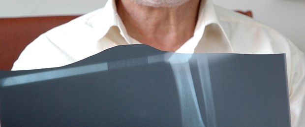 65 yıldır ayağındaki iğneyle yaşıyor