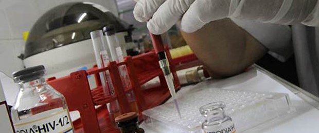 ABD'de evde HIV testine destek