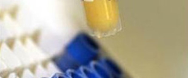 AIDS aşısı için önemli adım