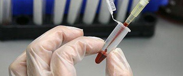 AIDS ile mücadelede dev adım