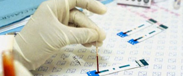AIDS'ten ölümler azaldı