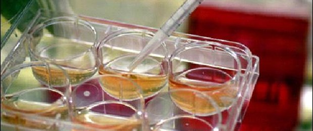 ALS hastası doktordan kök hücre uyarısı